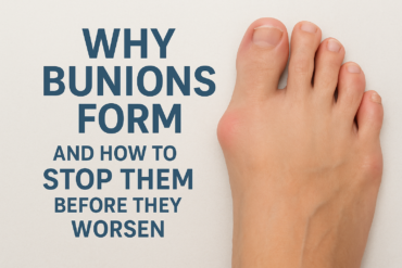 Why Bunions Form and How to Stop Them Before They Worsen