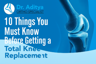 10 Things You Must Know Before Getting a Total Knee Replacement