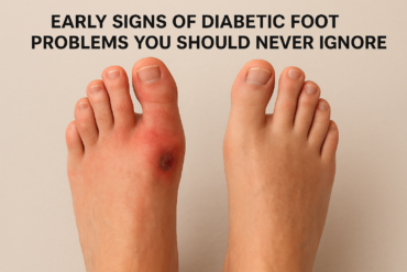 diabetic foot problems